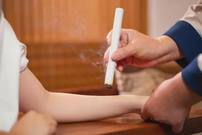 艾灸和拔罐的注意事項！